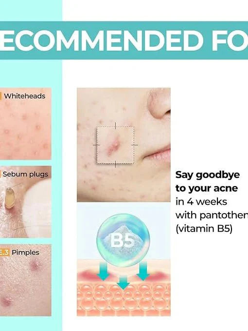 [numbuzin] No.1 Pantothenic B5 Active Soothing Cream [80ml] - Gesichtscreme